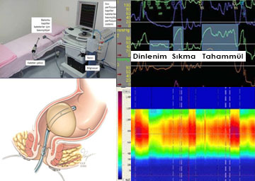 Anorektal Manometri, nedir