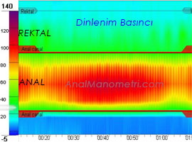 Anal Manometri, dinlenim