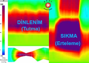 Anal Manometri, yüksek çözünürlüklü