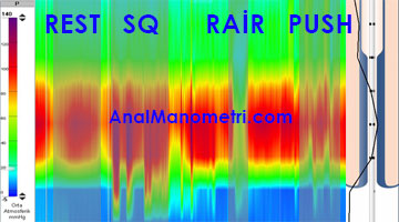 Sulu sistem 24 Kanallı Yükek Çözünürlüklü Anal Manometri