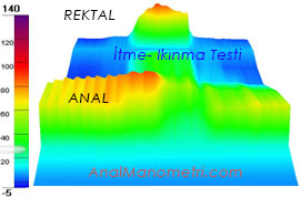 Anal Manometri, itme, ıkınma 3D