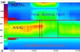 Anal Manometri, itme, ıkınma