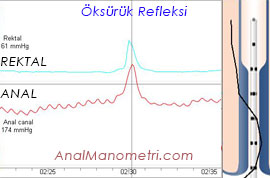 Anal Manometri, öksürük grafik