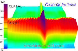 Anal Manometri, öksürük 3D