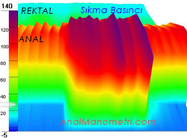 Anal Manometri, sıkma 3D