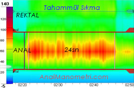 Anal Manometri, tahammül sıkma